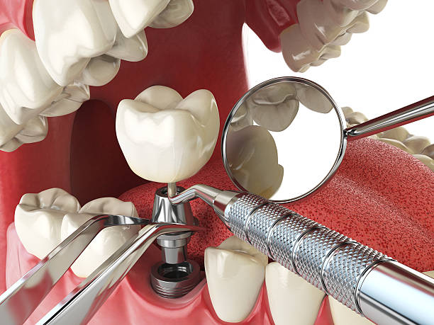 Best Emergency Treatment for Oral Infections in Zebulon, GA